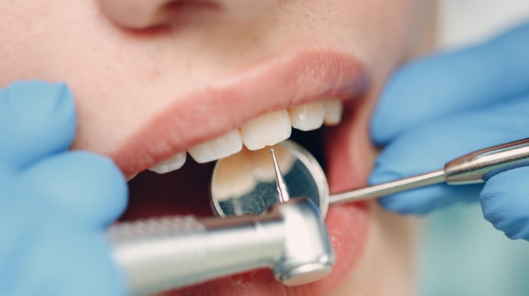 Podstawy zdrowego uśmiechu: Wszystko, co musisz wiedzieć o profilaktyce stomatologicznej