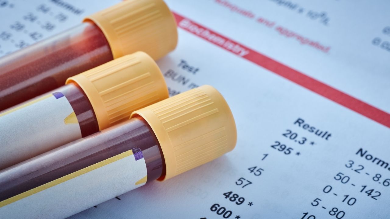 Znaczenie regularnych badań krwi dla zdrowia i prewencji chorób