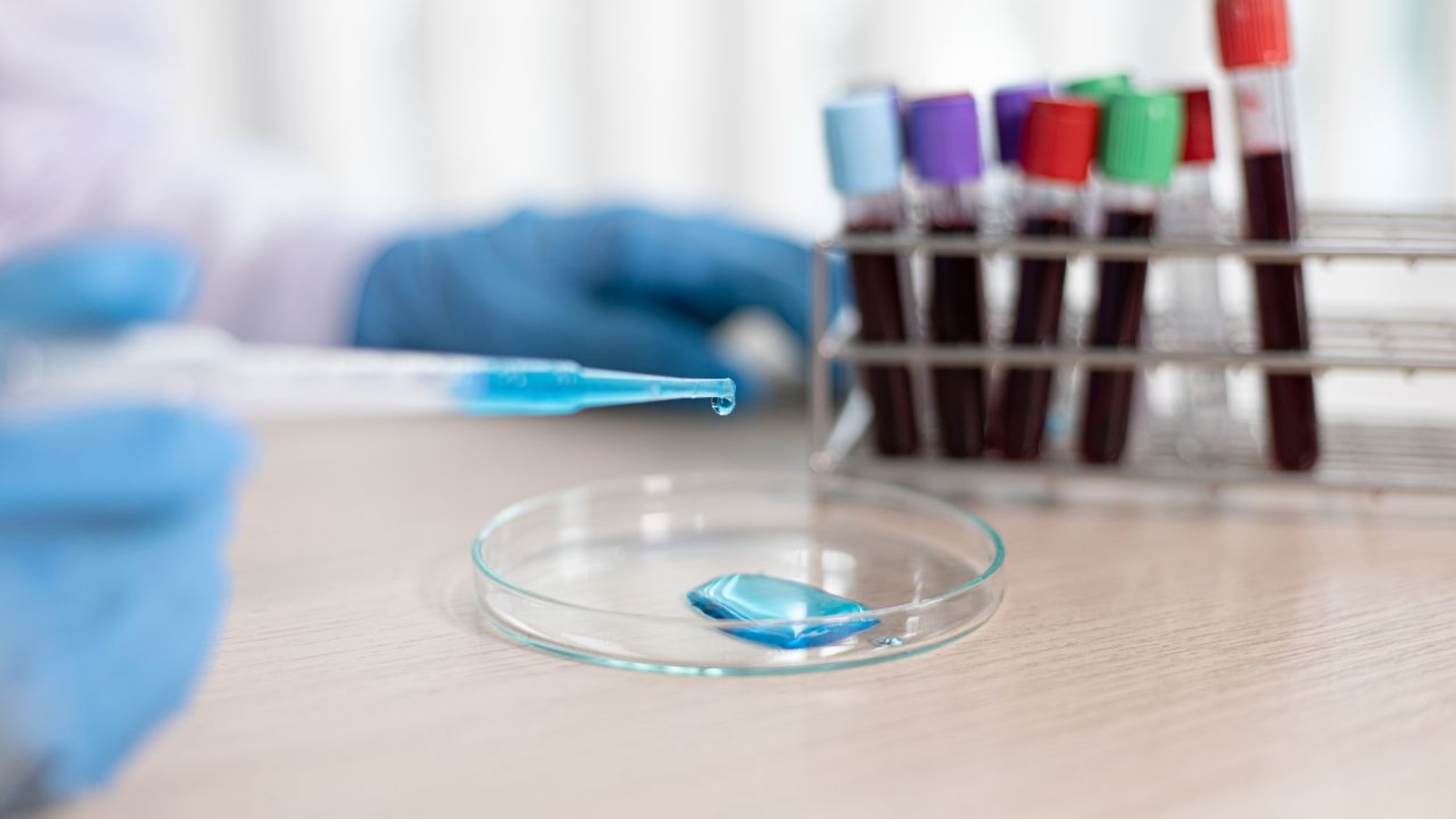 Czym są badania mikrobiologiczne i dlaczego są tak ważne?