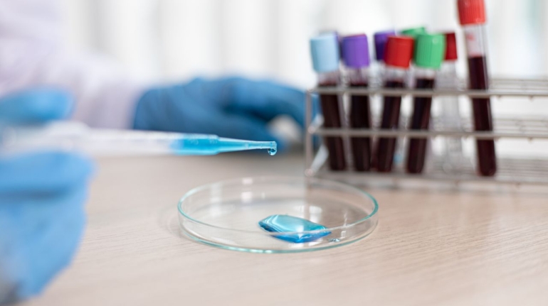 Czym są badania mikrobiologiczne i dlaczego są tak ważne?