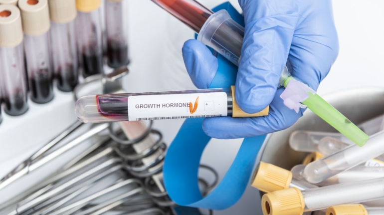 Dlaczego badania hormonalne są istotne dla Twojego zdrowia?