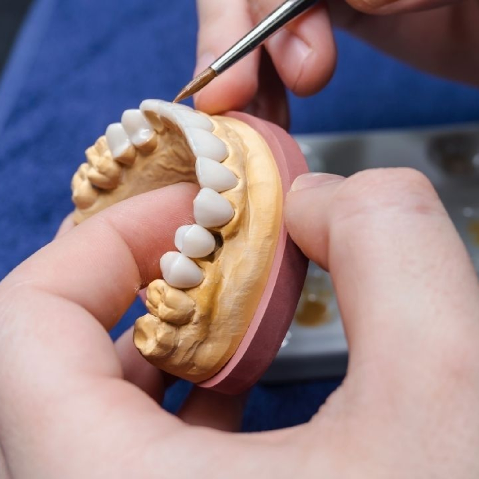 Jak protetyka zmienia jakość życia pacjentów dentalnych