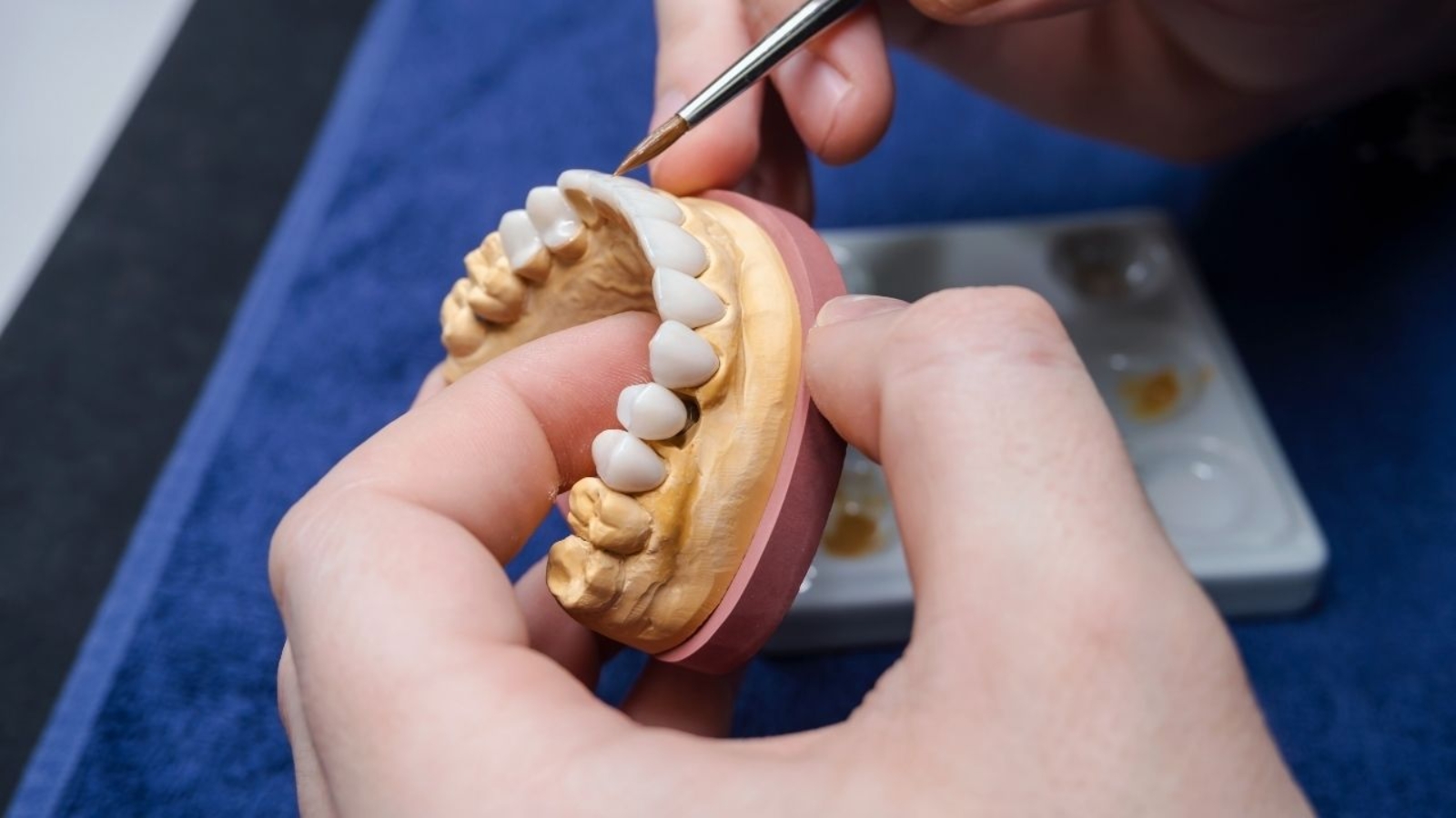 Jak protetyka zmienia jakość życia pacjentów dentalnych