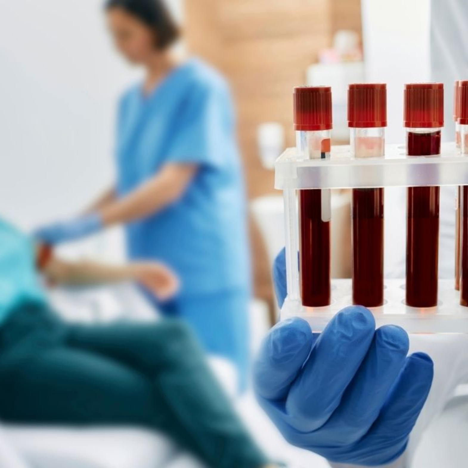 Jak przygotować się do badań laboratoryjnych? Praktyczny przewodnik dla pacjenta