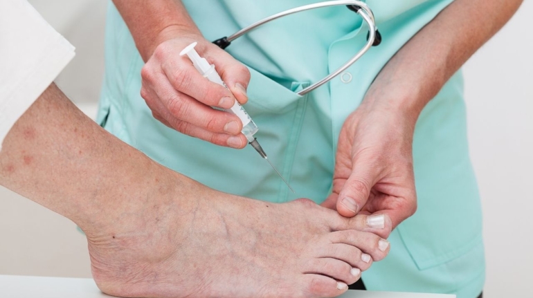 Understanding Bunion Treatment: Exploring the Right Time for Surgery