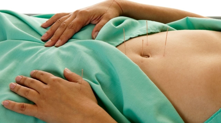 Fitoterapia i akupunktura w ginekologii – wsparcie naturalne po porodzie?