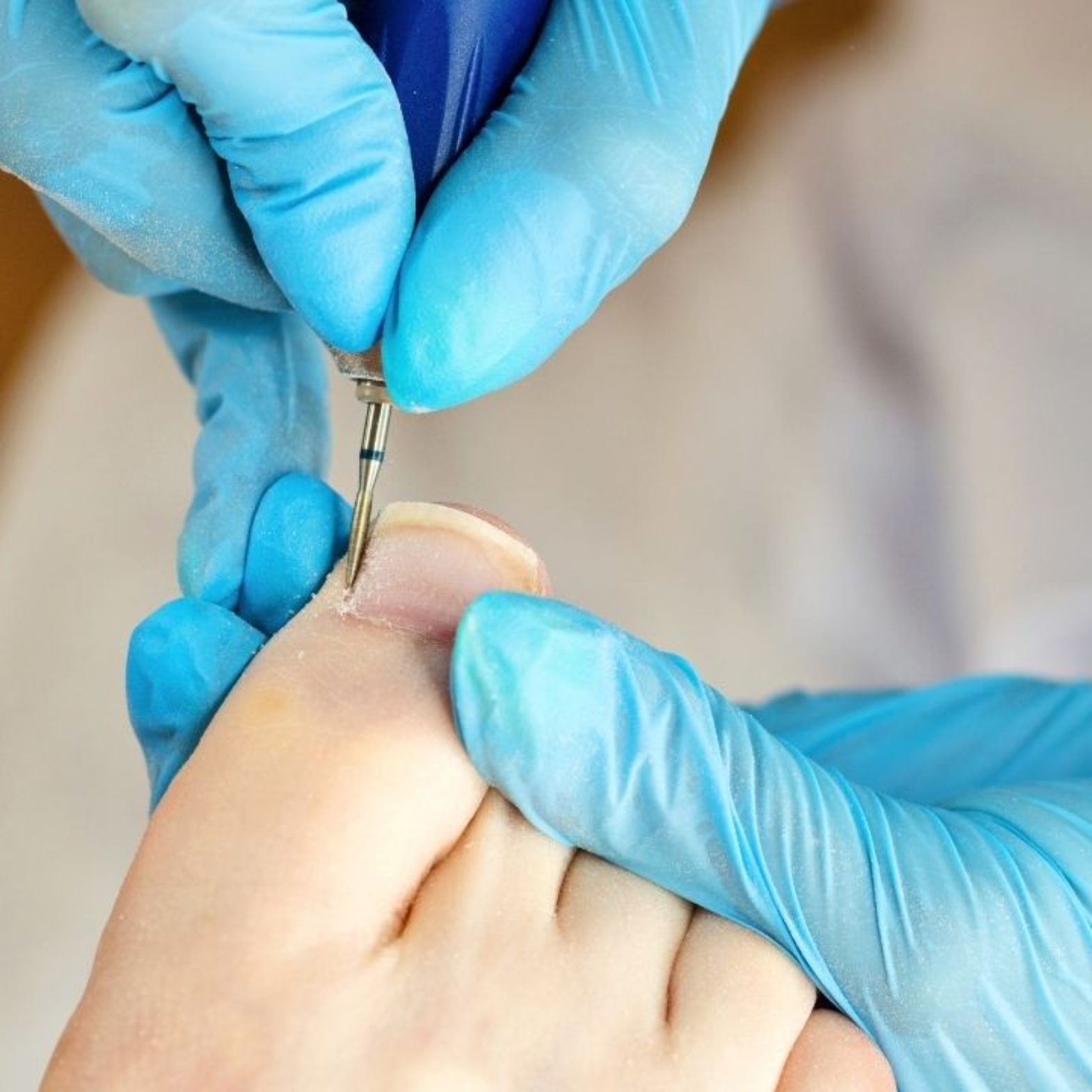 FAQ – Frequently Asked Questions Before Your Podiatry Visit