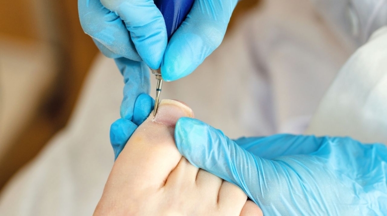 FAQ – Frequently Asked Questions Before Your Podiatry Visit