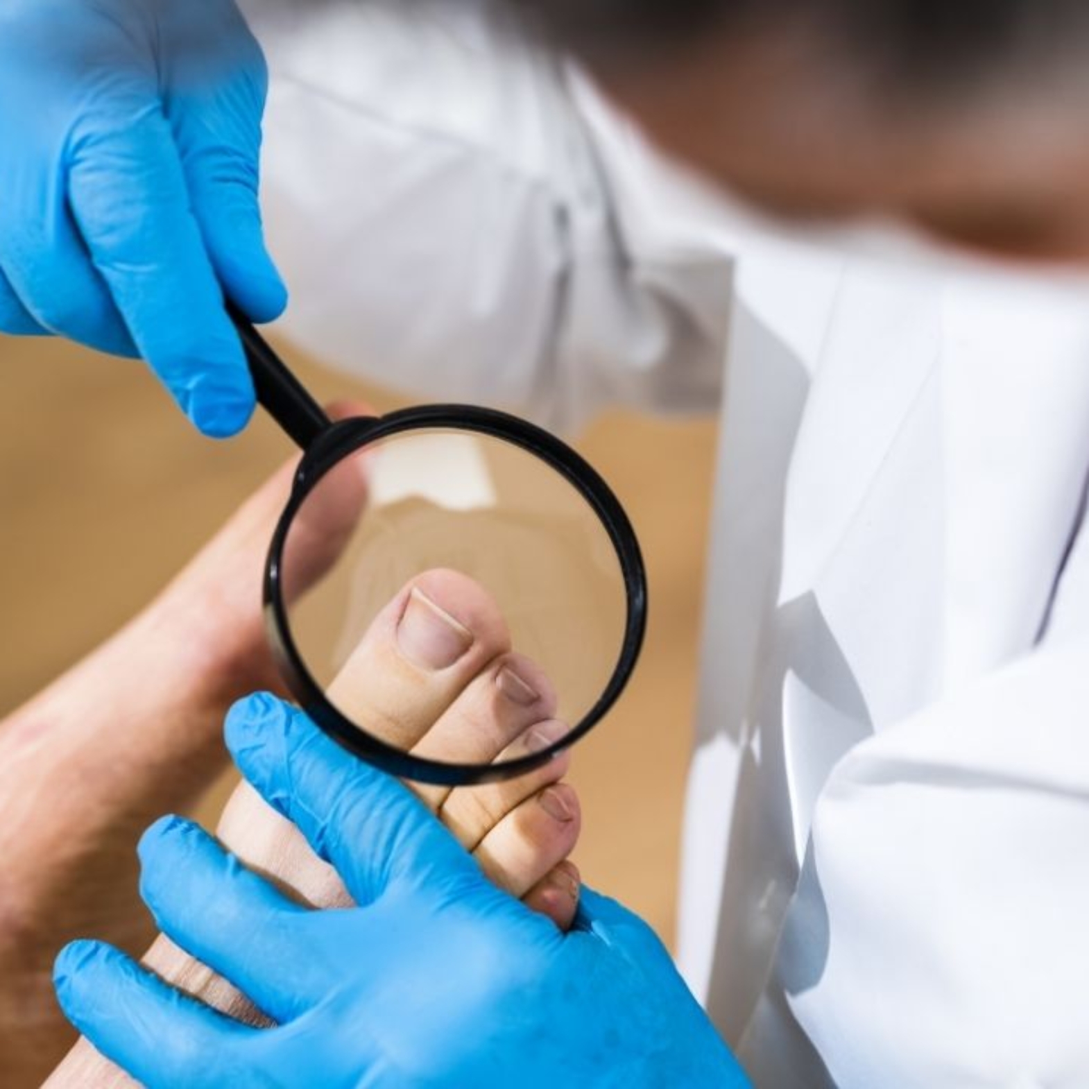 Ingrown Toenail Procedure - What Does the Clinic Treatment Involve?