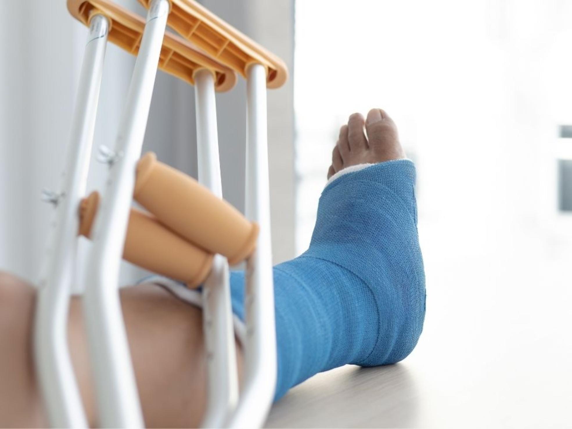 Złamanie kończyny dolnej – etapy rehabilitacji w domu z pomocą fizjoterapeuty