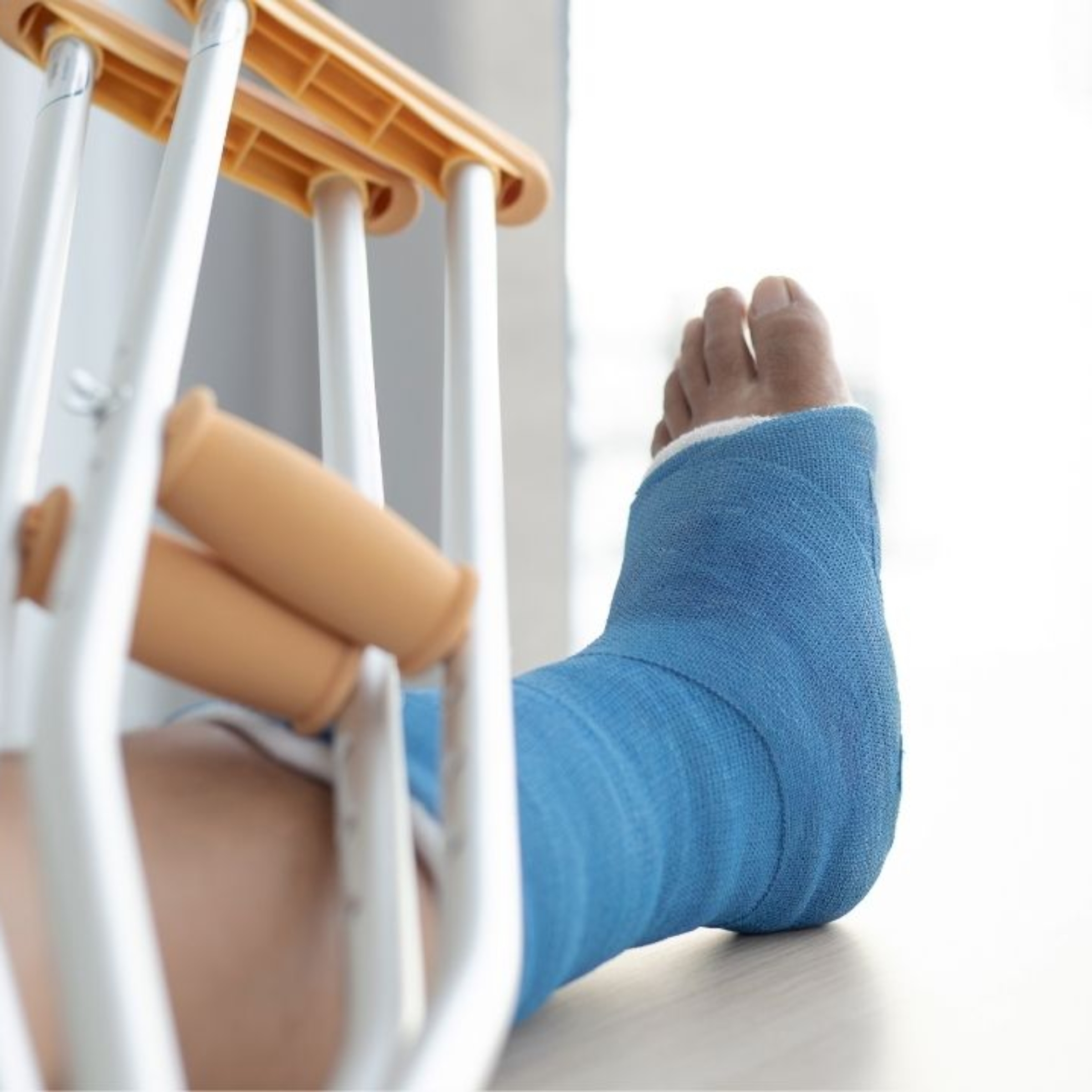 Złamanie kończyny dolnej – etapy rehabilitacji w domu z pomocą fizjoterapeuty