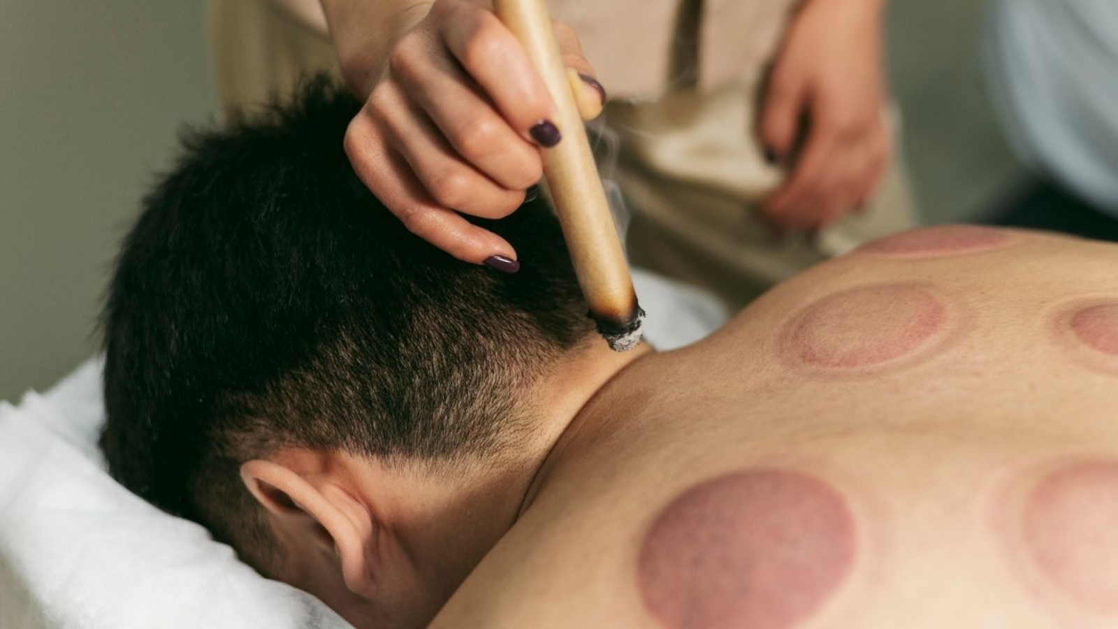 Medycyna chińska w rehabilitacji – jak pomaga