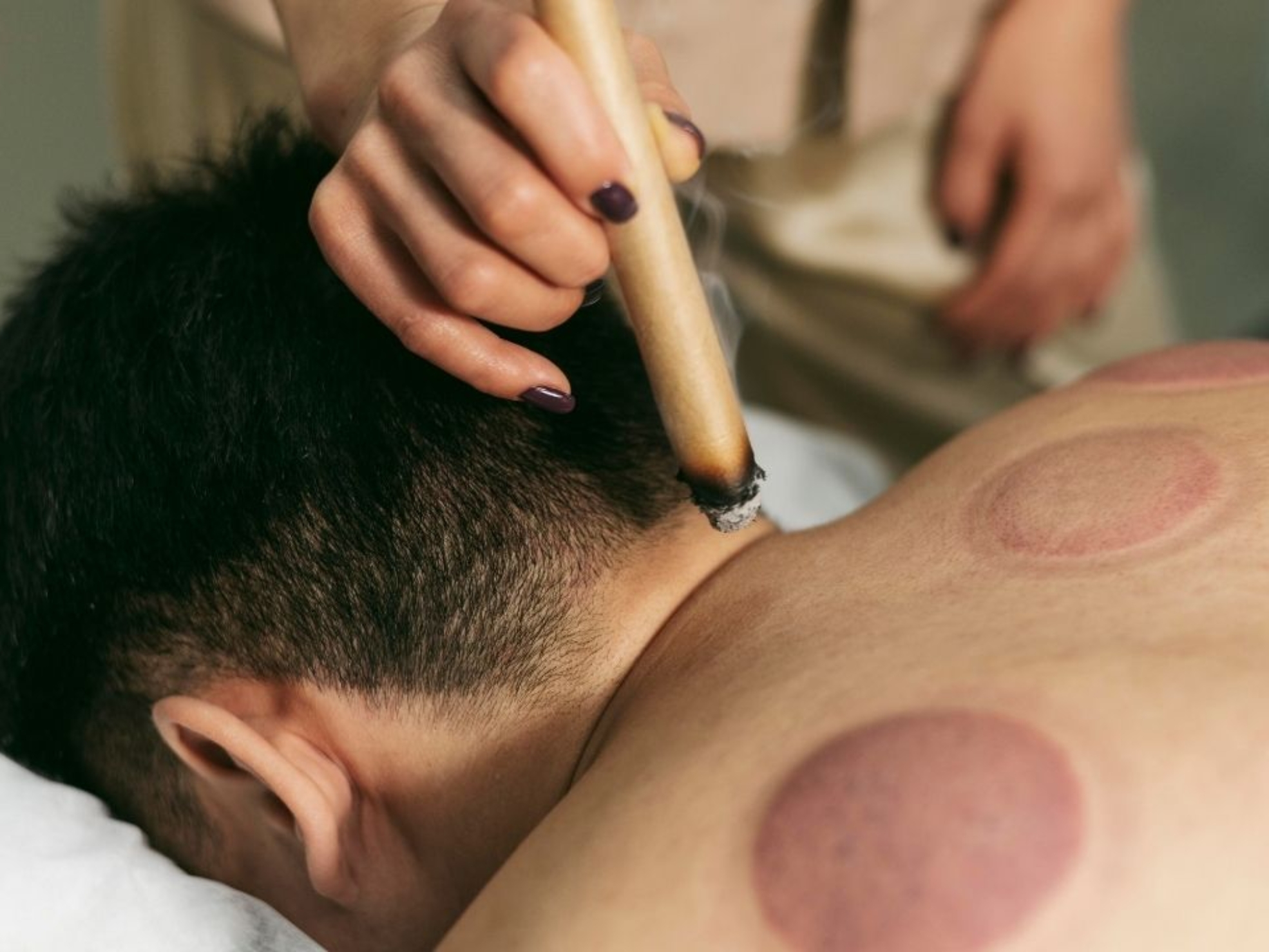 Medycyna chińska w rehabilitacji – jak pomaga